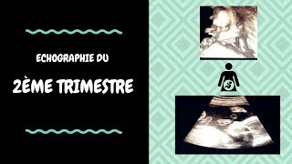 ECHOGRAPHIE DU 2ème TRIMESTRE [upl. by Llevrac]