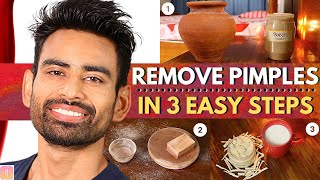 ULTIMATE Ayurvedic Routine to Get Rid of Pimples amp Acne Permanently Men amp Women [upl. by Moody241]