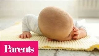 Cradle Cap  When to Worry  Parents [upl. by Ambrosia]