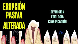 Erupción Pasiva Alterada qué es causas y clasificación [upl. by Dubois]