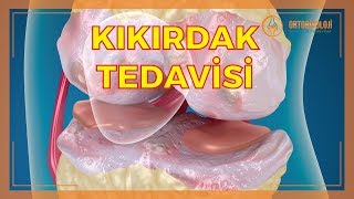 KIKIRDAK SORUNLARI NELERDİR KIKIRDAK TEDAVİLERİ NASIL YAPILIR [upl. by Enitsenrae]