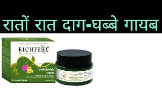 रातों रात दागधब्बो से छुटकारा पायें  Richfeel AntiBlemishe cream Review [upl. by Atilem]