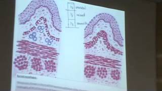 Dr Gihan Esophagus 23102013 [upl. by Meyer]