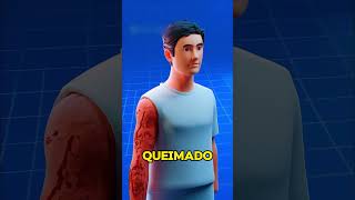 E SE JOGAR ÁCIDO ESTOMACAL NO BRAÇO 😱 shorts [upl. by Ditmore609]