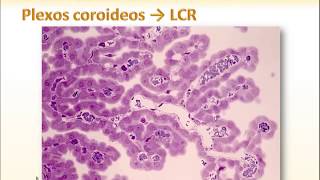 13 LCR y Plexos coroideos [upl. by Nylikcaj]