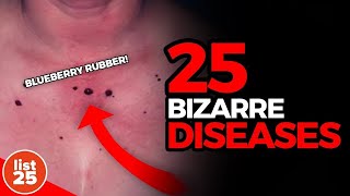 25 BIZARRE DISEASES Science Cant solve [upl. by Meingolda]