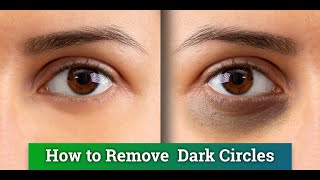 Remove Dark Circles With Toothpaste And Vitamin E Capsules  How Simple Remedies [upl. by Lambard563]