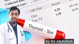 Thyroid Profile  Thyroid Test  Thyroid Function Test  TSH  T3 amp T4  How to read thyroid report [upl. by Nikos368]