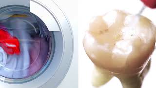 SmartLite Pro EndoActivator™ Washing Machine Comparison [upl. by Suertemed767]