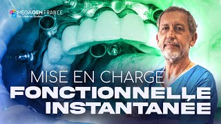 Mise en charge fonctionnelle instantanée [upl. by Ordnagela104]