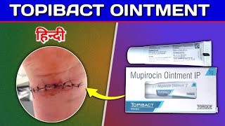 Topibact Ointment  Mupirocin ointment Review in Hindi [upl. by Stevens]