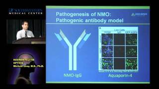 Neuromyelitis Optica [upl. by Weinhardt]