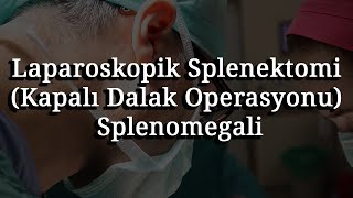 Laparoskopik Splenektomi Kapalı Dalak Operasyonu Splenomegali [upl. by Adni]