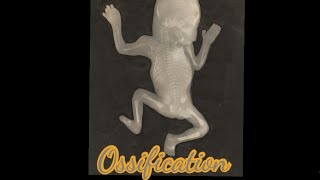 Ossification  Meaning  Pronunciation  Usage [upl. by Noskcaj221]