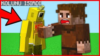 BEBEK TEPEGÖZ FAKİRİN KOLUNU ISIRDI 😂  Minecraft [upl. by Shlomo511]