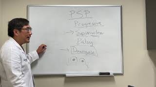 Downgaze and upgaze paresis in progressive supranuclear palsy PSP [upl. by Arratoon838]