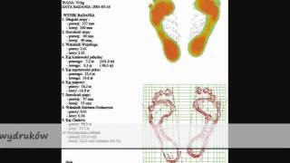 PODOSKOP3DFirmaKOORDYNACJAMariuszStrzechawmv [upl. by Ushijima542]