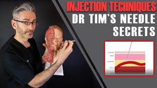 Injection Techniques Best Angles Depths How To Aspirate amp Stabilise Aesthetics Mastery Show [upl. by Annairt946]