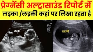 Pregnancy ultrasound se kaise pata krein ki ladka hai ya ladki [upl. by Giza]