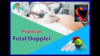 Practical Obstetric Doppler  Umbilical Artery Doppler [upl. by Zenia]