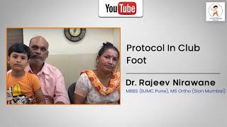 Importance Of Splint Protocol In Club Foot [upl. by Efron]