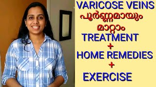 VARICOSE VEIN പൂർണമായും മാറ്റാംVaricose vein treatmentHome remediesExercises [upl. by Zuzana548]