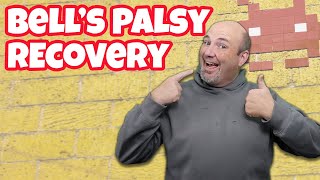 Recovery and Side Effects of Bells Palsy  1 Year Later [upl. by Gregorio905]