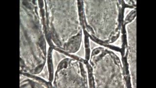 Plasmolisi in laboratorio Fenomeno osservato a velocità 8x [upl. by Ttoille]