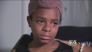 13YearOld Girl Speaks Out After Bully Set Her Hair On Fire [upl. by Asiuqram196]