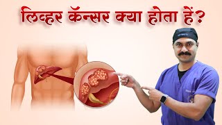 क्या Liver Cancer को ठीक कर सकते है Liver Cancer Treatment  DrBipin Vibhute  Hindi [upl. by Akeme378]