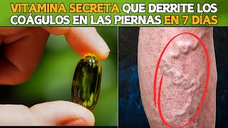 💊🚨 La VITAMINA SECRETA Que Disuelve los Coágulos de Sangre en Tus Piernas 🦵💥 [upl. by Lyrradal]