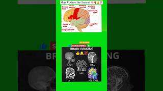 brain🧠 ✅anatomy👇 physiology 🧠🧫✨mbbs 🌟medical video neet🫀biology science viralshorts video [upl. by Ennahtebazile646]