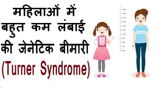 महिलाओं में बहुत कम लंबाई की जेनेटिक बीमारी  Turner syndrome in hindi [upl. by Aleydis231]