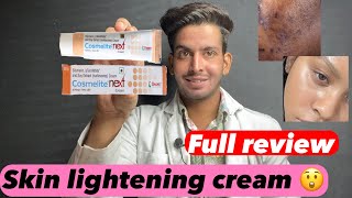 Cosmelite cream  Cosmelite cream ke fayde aur nuksan  Cosmelite cream review  cosmelite use [upl. by Trini]