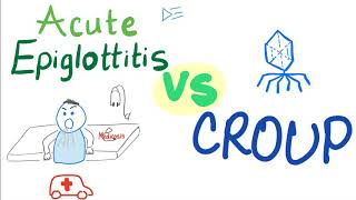 Acute Epiglottitis Vs Croup  A Detailed Comparison [upl. by Ociredef584]