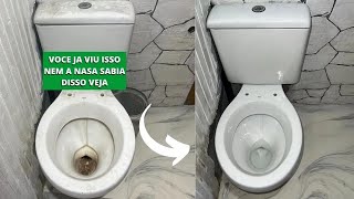 VEJA QUE IDEIA BRILHANTE COMO TIRAR AMARELADO ENCARDIDO CROSTA E MARCA DÁGUA D VASO SANITÁRIO FACIL [upl. by Jenette64]