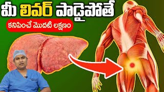 10 Symptoms of Liver Problem  Fatty Liver Symptoms  liver damage Sign  Dr Sachin Daga [upl. by Apfelstadt]