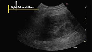 Abdominal Ultrasound Examination Screening Exam Dog [upl. by Tennies]