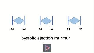 Systolic ejection murmur [upl. by Ahtelrac]