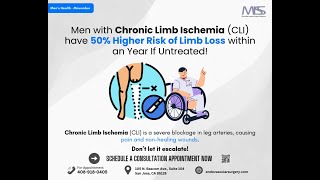 Chronic Limb Ischemia Expert Care for Men at MISS [upl. by Materi]