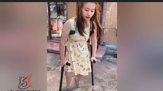 A disabled woman with polio walks on crutches polio [upl. by Kaya]