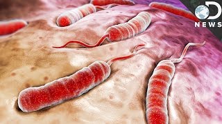 What Exactly Does Cholera Do To Your Body [upl. by Adnuahsal]