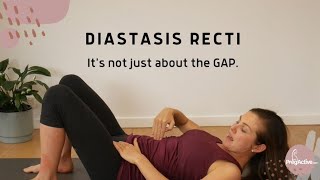 Diastasis Recti Abdominal Separation Gap [upl. by Moclam]