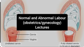 Dysfunctional uterine contractions and its management Abnormal labour part 8  obstetrics chapter12 [upl. by Allrud]