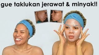 BIAR GAK JERAWATAN LAGI Acne ProneOily Skin Care Routine Gue [upl. by Constantina]