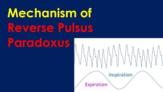 Mechanism of Reverse Pulsus Paradoxus [upl. by Mashe]