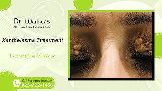 Xanthelasma I Xanthelasma Treatment I Dr Walias Skin and Hair Transplant Clinic [upl. by Rivard441]