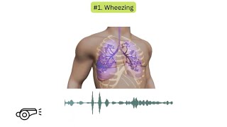 Abnormal lung sounds in COPD [upl. by Ynnek]