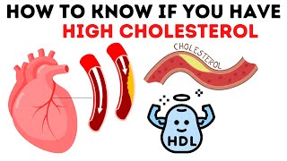 High cholesterol symptoms causes and treatment  Signs of high cholesterol in Hindi [upl. by Lada164]