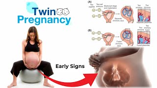 twins pregnancy  twins pregnancy week by week video  care during twin pregnancy [upl. by Releehw]